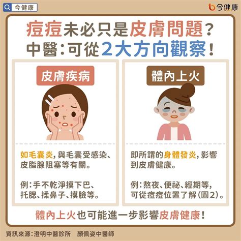 喉嚨長一顆痘痘|喉嚨長痘痘：休息、避免刺激、止痛、戒菸戒酒